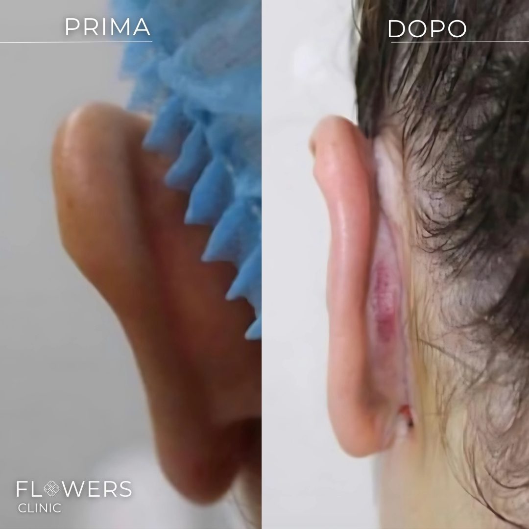 interventi estetici per italiani all estero