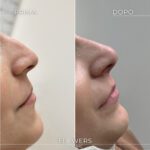 estetica avanzata per donne