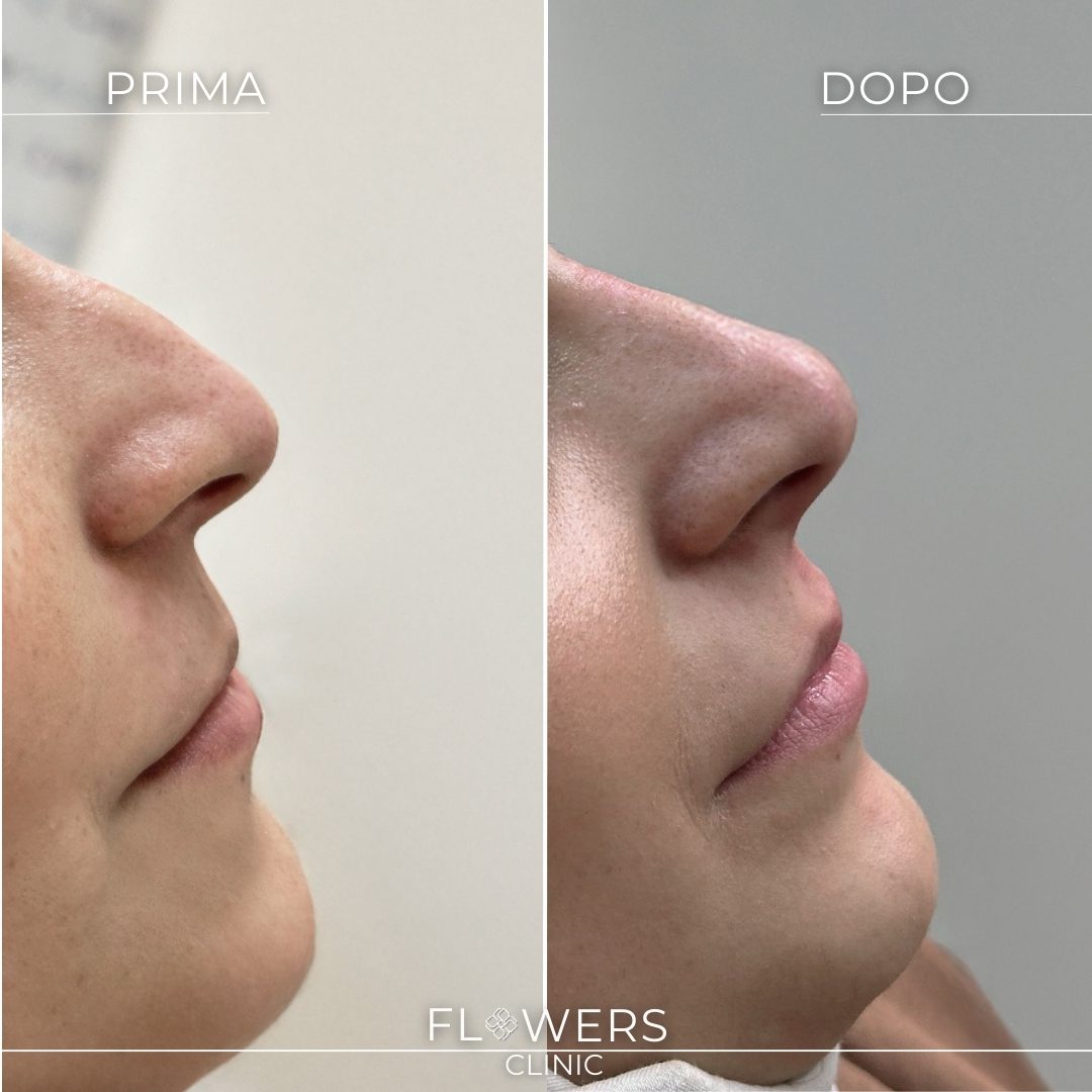 estetica avanzata per donne
