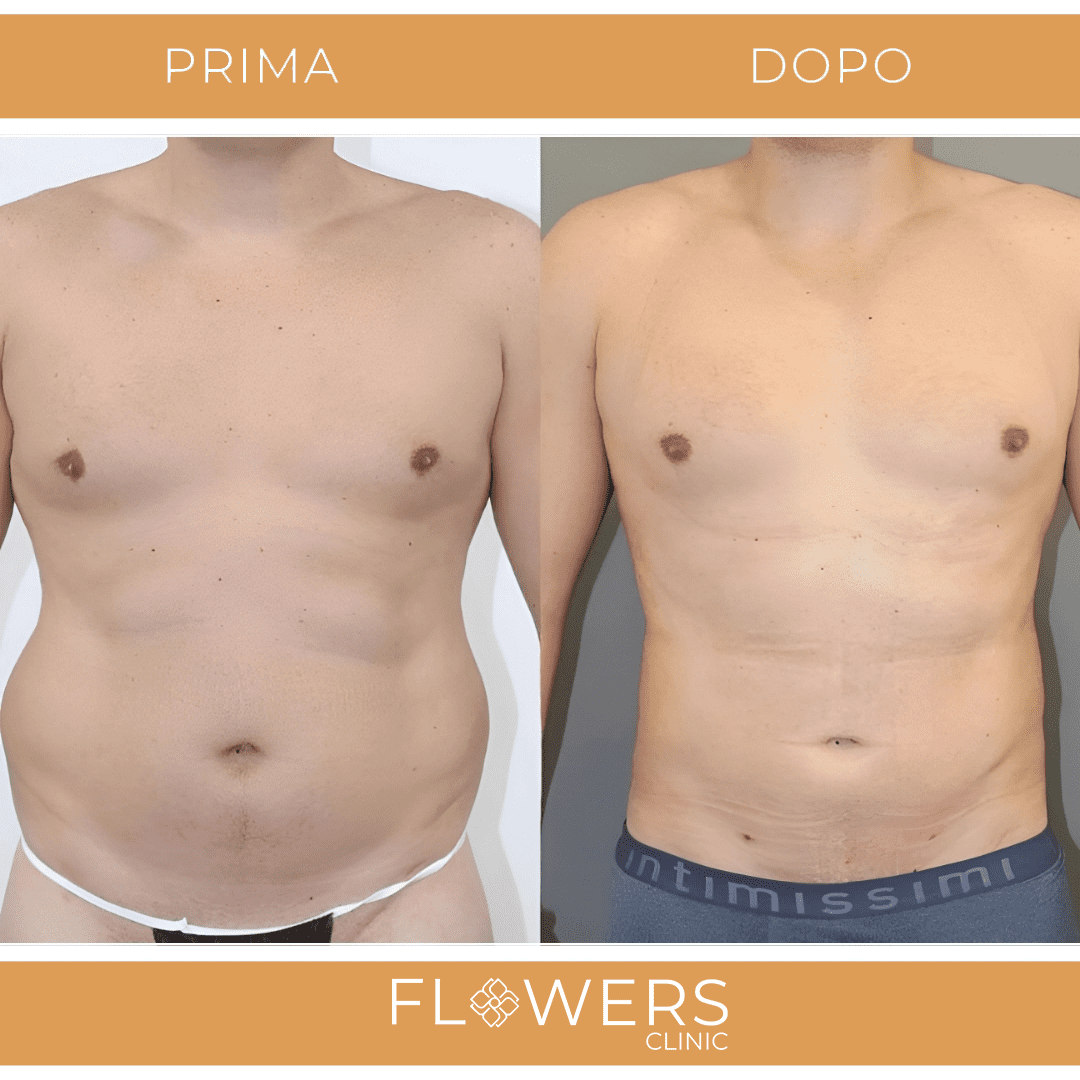 clinica estetica nel cuore di Istanbul