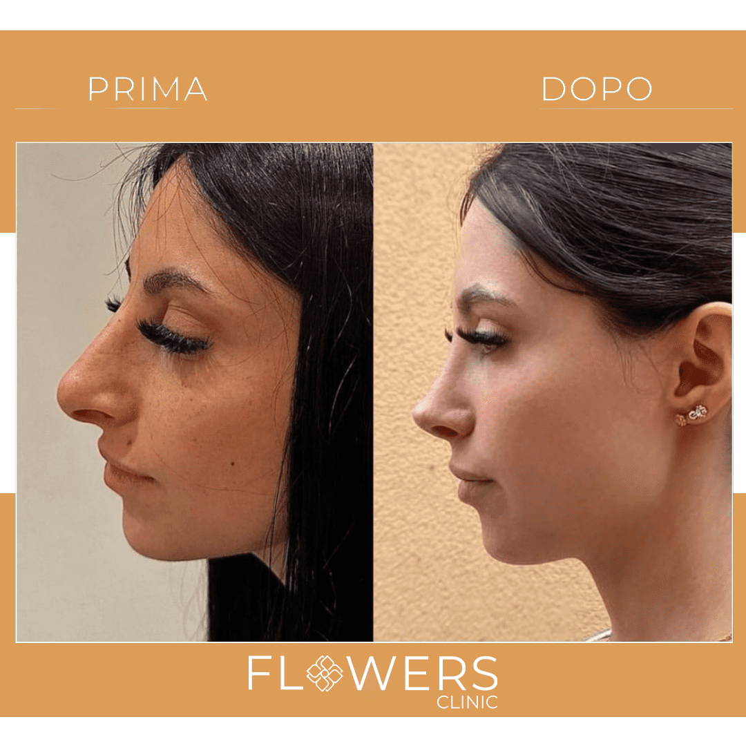 follow-up post operatorio con verifica dei risultati
