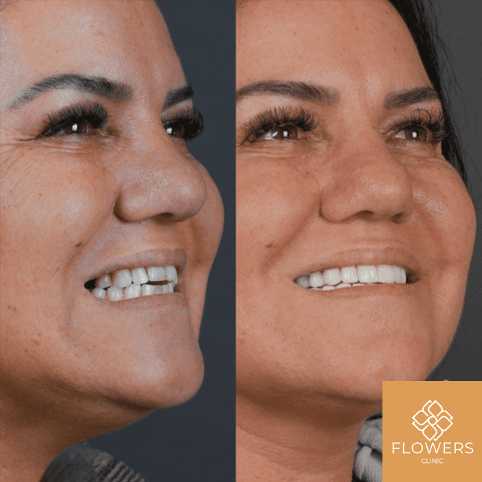 chirurgia viso corpo Istanbul