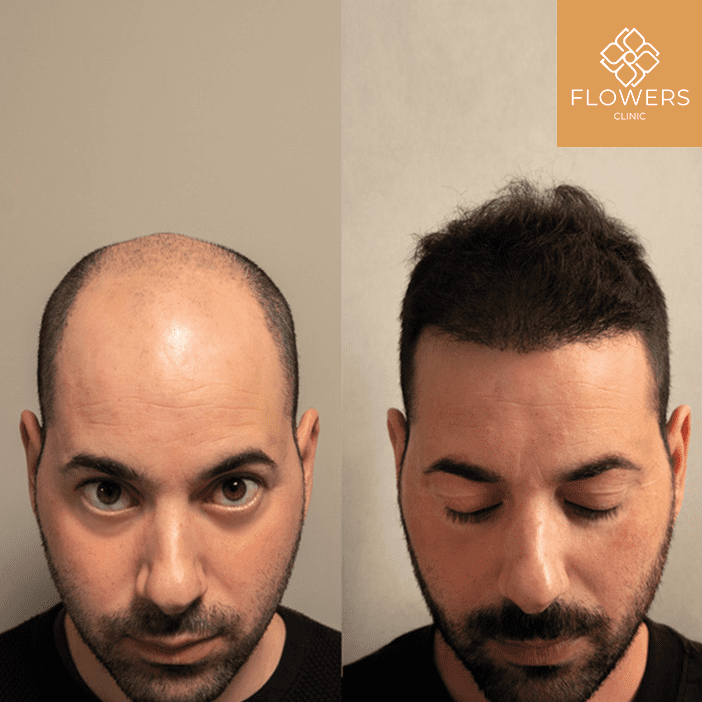 esperienza benessere e relax post operatorio