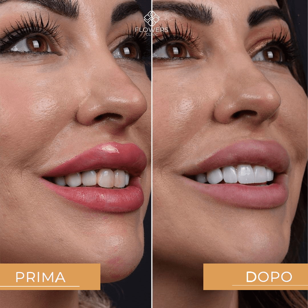 lifting viso uomo naturale
