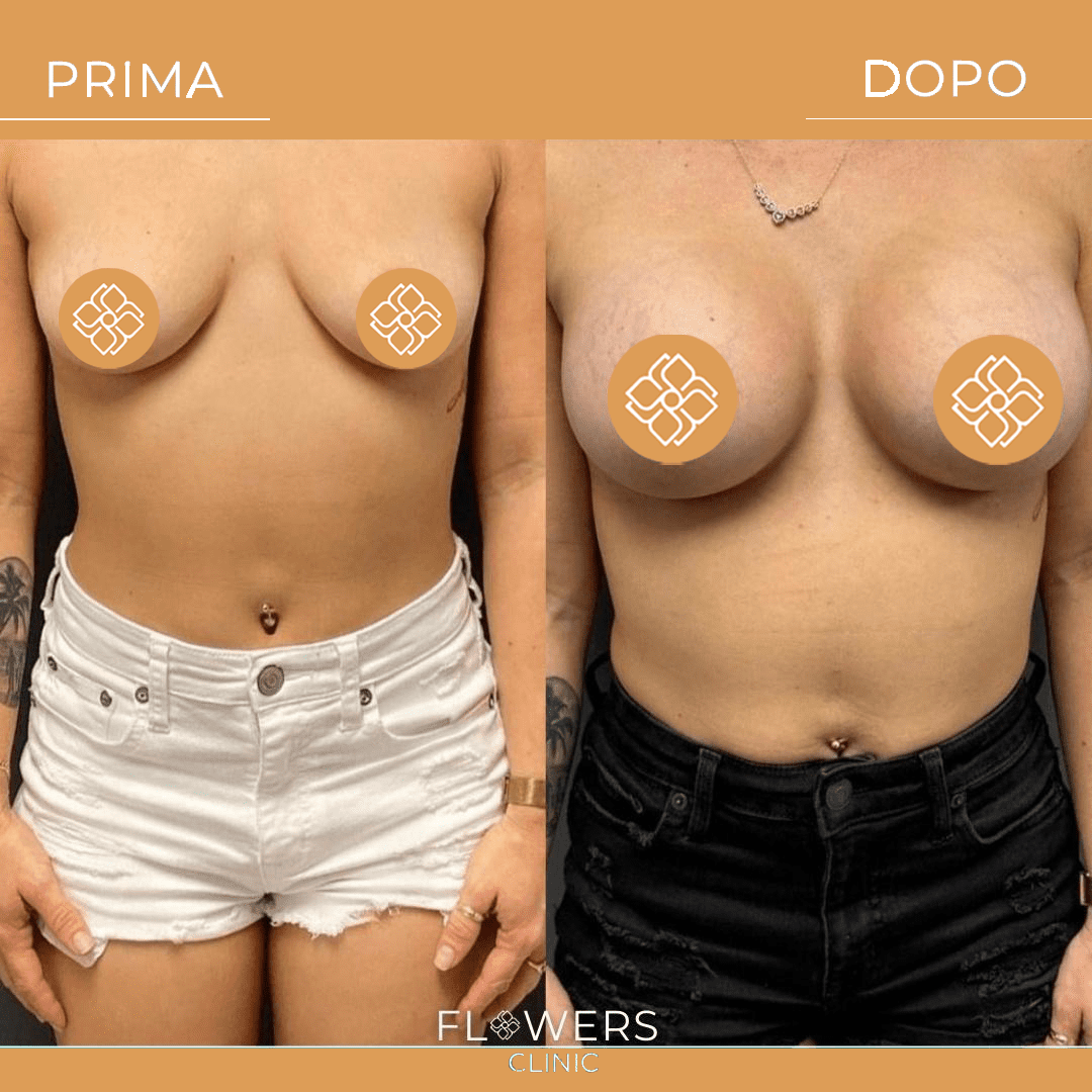 terapie anti età personalizzate