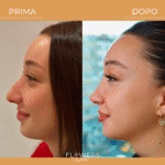mommy makeover Istanbul